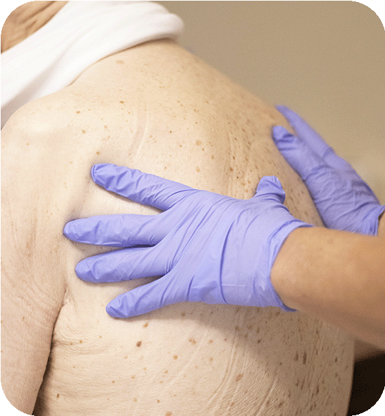 Enfermagem de Reabilitação